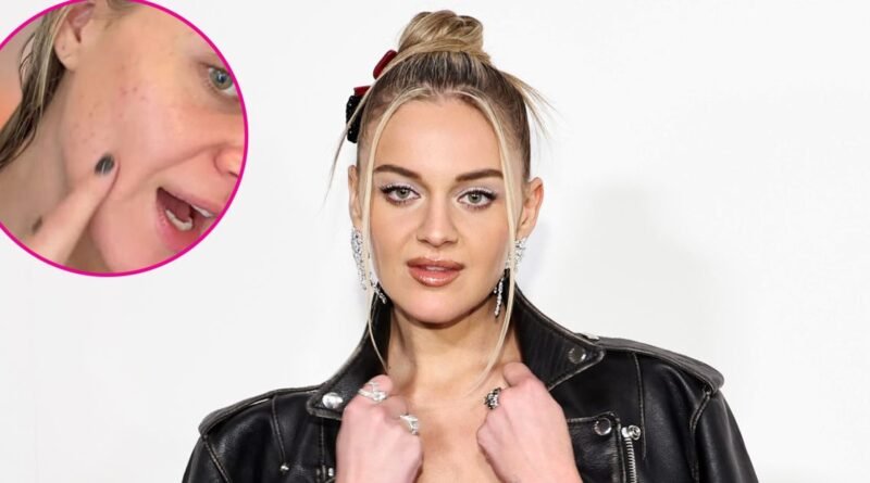 Kelsea Ballerini Opens Up About Experiencing a 'Stress Rash' Before Her Performance