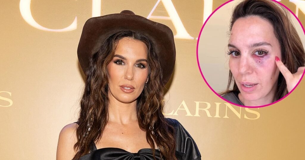 Christy Carlson Romano Reportedly Injured in the Eye on Her Husband's Birthday