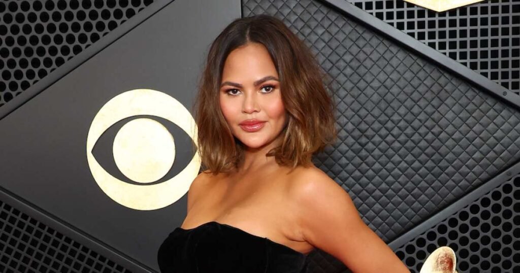 Chrissy Teigen Reveals Details About Her Bandaged Face Procedure