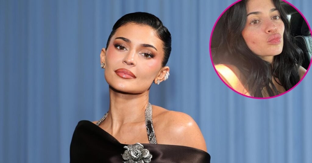 Kylie Jenner Embraces Her Natural Look Featuring a 'Pimple Pal'