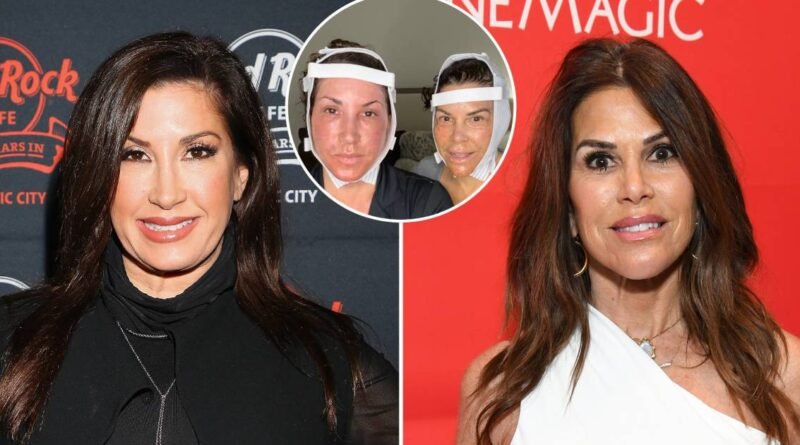 Facelift Insights from Real Housewives Stars Jacqueline Laurita and Lynne Curtin