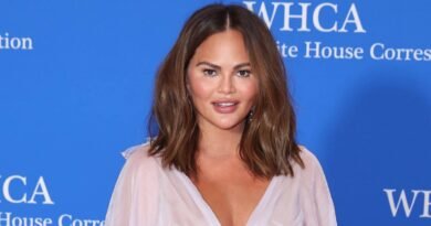 Chrissy Teigen Reveals Bandaged Face During Instagram Live Session