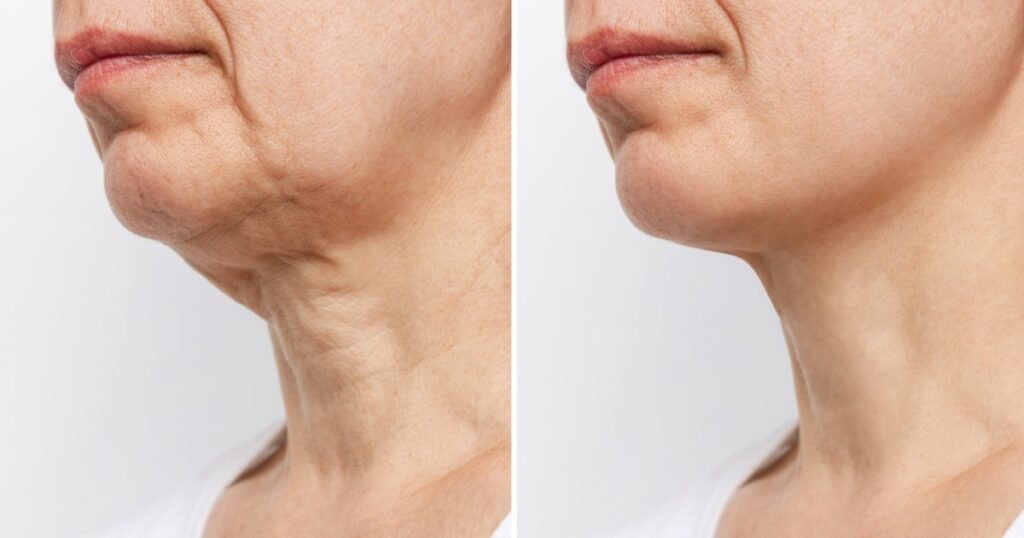 This Cream Helps Women Over 40 Firm and Smooth Crepey Skin at Home