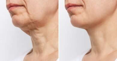 This Cream Helps Women Over 40 Firm and Smooth Crepey Skin at Home