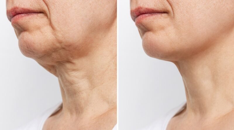 This Cream Helps Women Over 40 Firm and Smooth Crepey Skin at Home