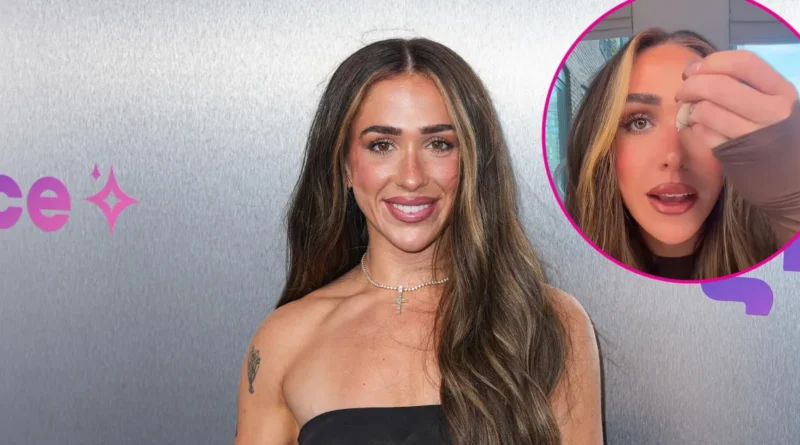 Ariana Biermann alleges that Kim Zolciak had her freckles removed with laser treatment at age 14.