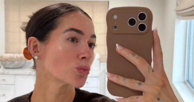 Influencer Avery Woods Undergoes Botox Treatment to Achieve a ‘Decade-Younger’ Look