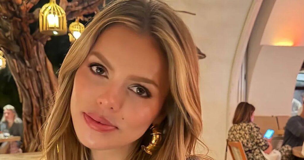 Brooks Nader Reveals Her Slimmed-Down Lips After Dissolving Lip Filler