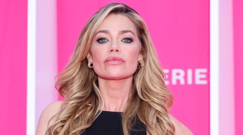 Celebrities Open Up About Plastic Surgery: Denise Richards and Others