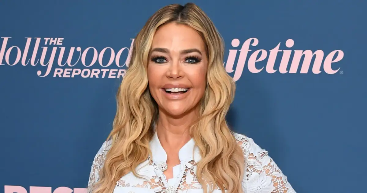 Denise Richards’ Surgeon Explains Her Facelift Procedure