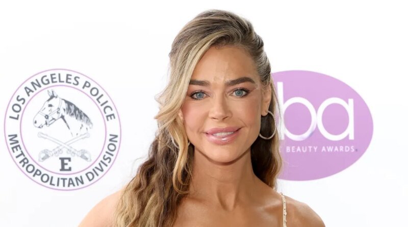 Denise Richards Shares Stunning Before-and-After Facelift Images