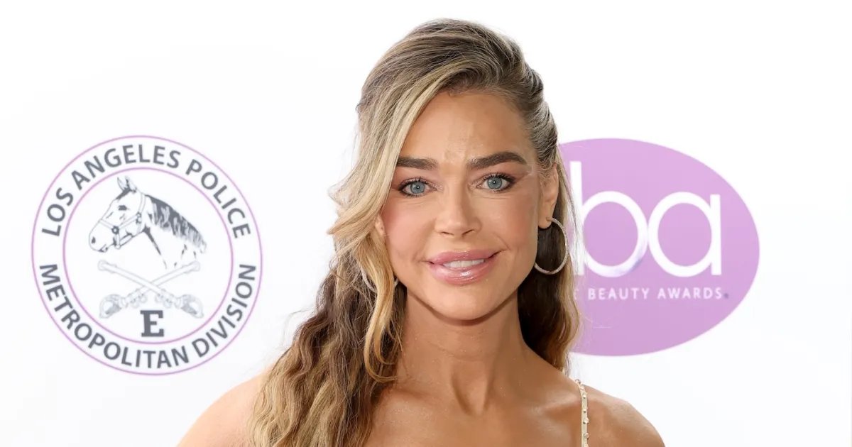 Denise Richards Shares Stunning Before-and-After Facelift Images