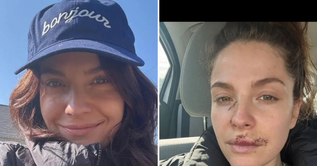 Paige Spara from The Good Doctor Shares Update on Dog Attack Injury