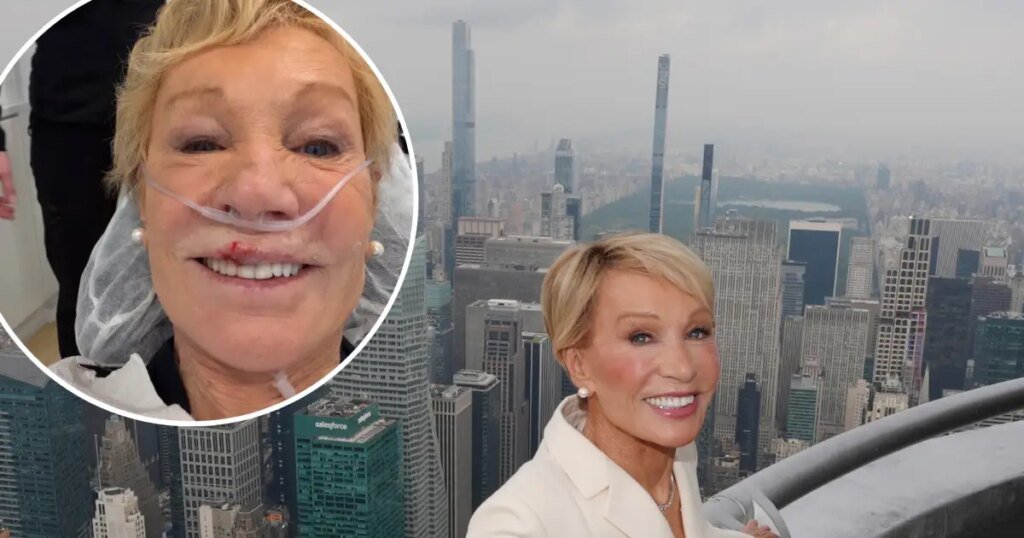Barbara Corcoran Reveals Aftermath of Broken Tooth and Split Lip