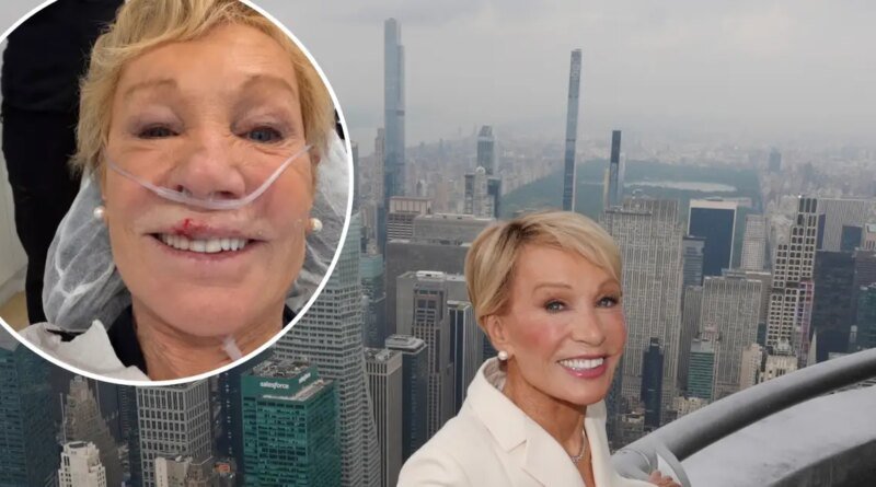 Barbara Corcoran Reveals Aftermath of Broken Tooth and Split Lip