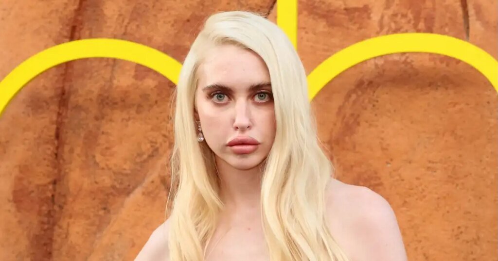 Chloe Cherry from Euphoria Shares Her Experience with Lip Fillers