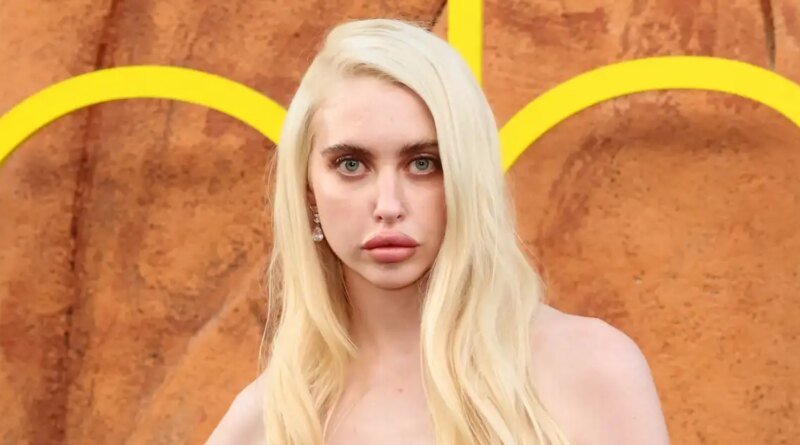 Chloe Cherry from Euphoria Shares Her Experience with Lip Fillers