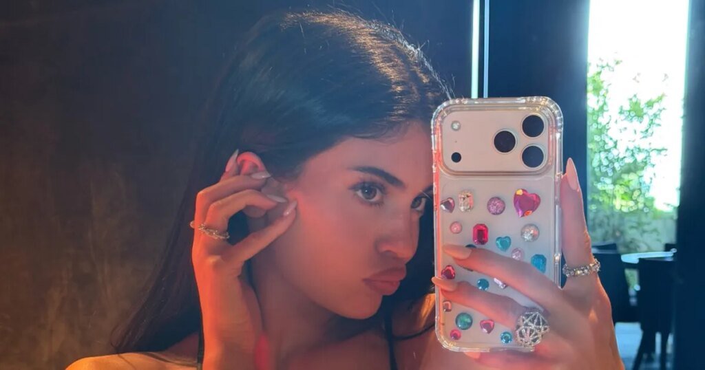 How Kylie Jenner Coping with Her 'Severe' Breakouts
