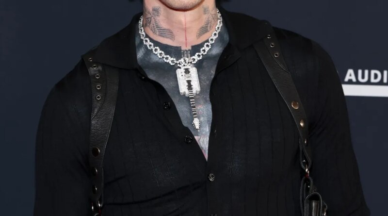 MGK Posts Gruesome Ring Photo, Highlights Pimple Up Close