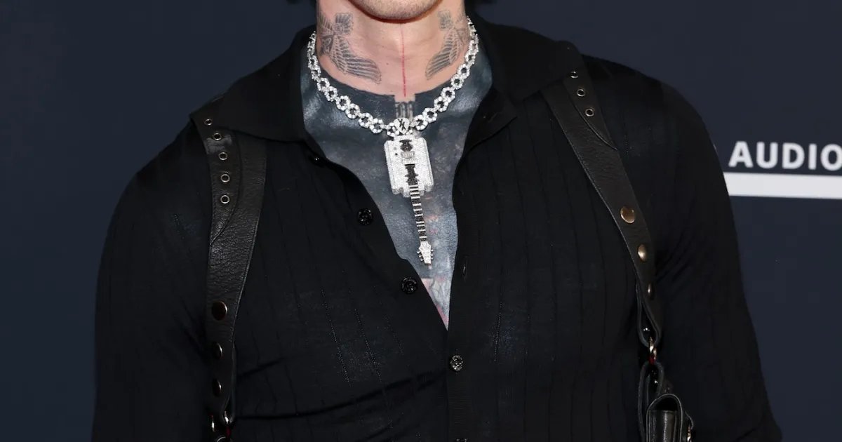 MGK Posts Gruesome Ring Photo, Highlights Pimple Up Close
